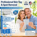 🚩TopSpire®🔥🐟Advanced Microneedle Skin Tag Removal Patch for Fast, Visible Results