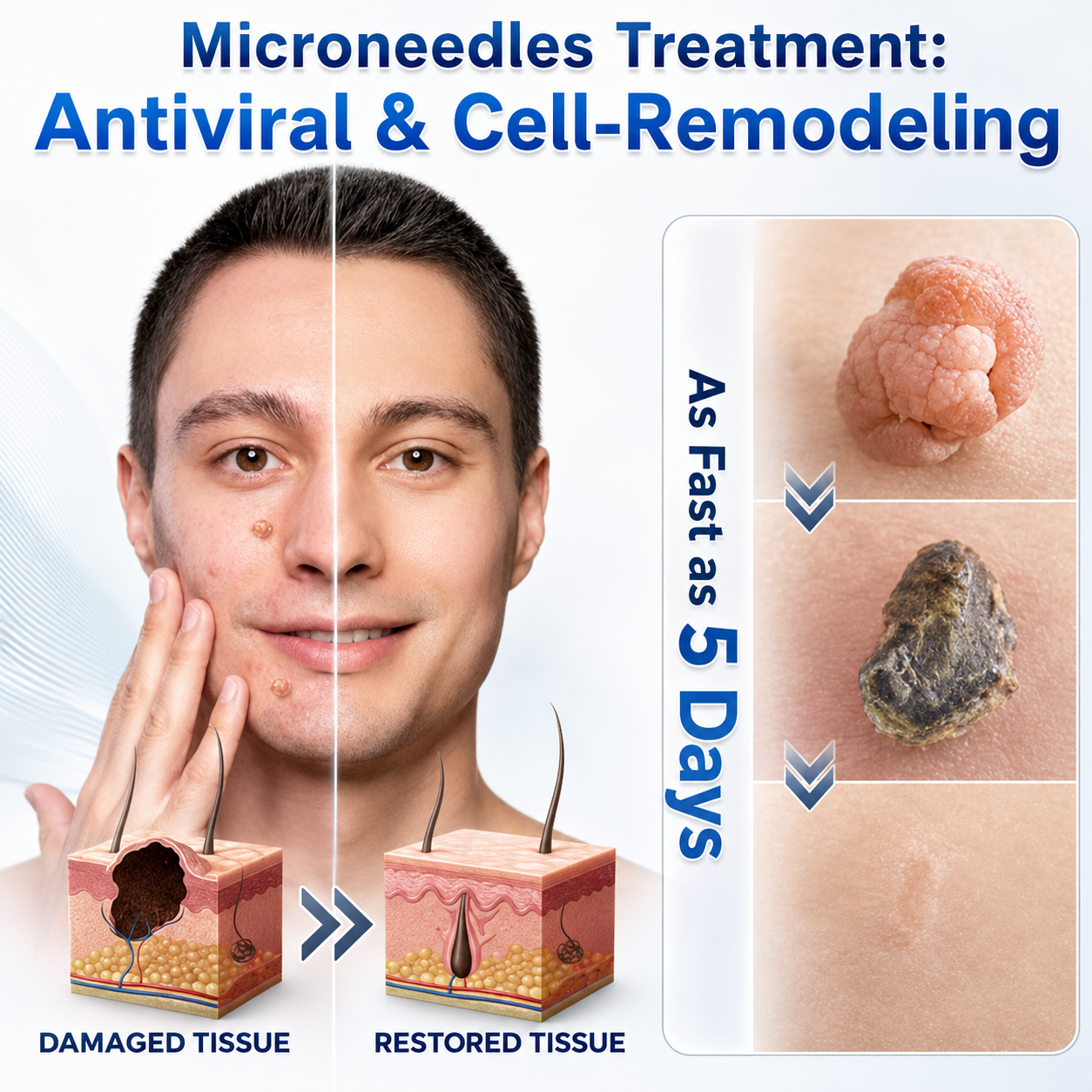 🚩TopSpire®🔥🐟Advanced Microneedle Skin Tag Removal Patch for Fast, Visible Results